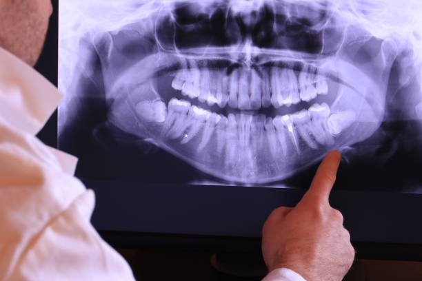 Best Emergency Dental Care for Broken or Chipped Teeth in Osceola, AR
